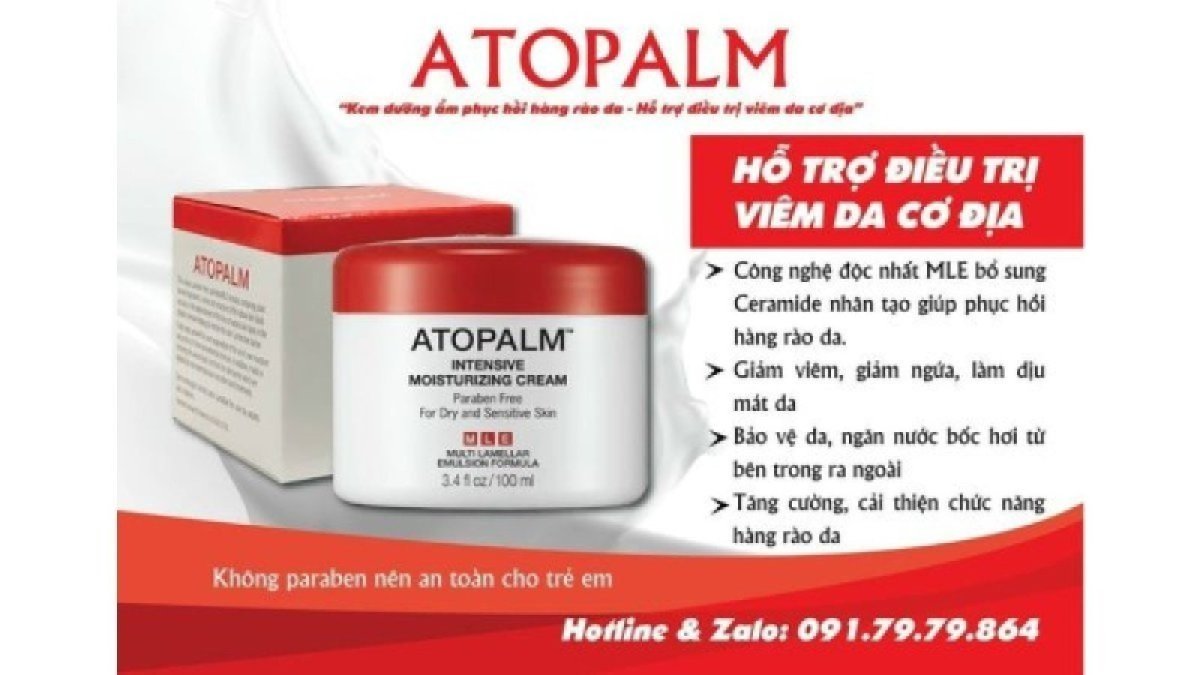 Kem Atopalm hỗ trợ điều trị chàm viêm da cơ địa ở người lớn và trẻ em
